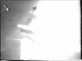 Cicatriz - Cuidado Burocratas