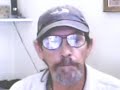 Hemochromatosis. The Silent Killer