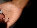 cyst cyst
