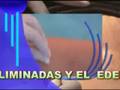 videos de SALUD ALTERNATIVA  DEPILACION DEFINITIVA Y MAS