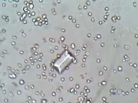 how to treat rbc in urine