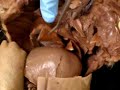 A&P 2 Pig Disection: Soft palate, hard palate, larynx... A&P 2 Pig Disection: Soft palate, hard palate, larynx...