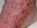 Linking Data Points - Chemtrails, Nano Tech, Morgellons Linking Data Points - Chemtrails, Nano Tech, Morgellons