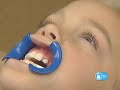 Children & Braces