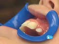 Children Braces Children Braces
