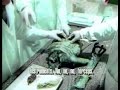Russian Alien Autopsy - 2008