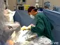 OR-Live.com presents: Surgical Tutorial on Complex da Vinci® Hysterectomy: Strategies for Managing Endometriosis, Prior Pelvic Surgery and Large UteriSeptember 18, 2008 at 4:00 PM EDT (20:00 UTC)From University of Michigan Health SystemThe University of Michigan Health System and Intuitive Surgical, Inc. will present the second in a series of surgical tutorials on Complex da Vinci (robotic) Hysterectomy on September 18, 2008 from 4:00-5:30 PM (ET). Dr. Arnold P. Advincula, Associate Professor of Obstetrics and Gynecology and Director of the Minimally Invasive Gynecologic Surgery Program and Fellowship at the University of Michigan Health System, will moderate the event to explain critical portions of the surgery and to answer e-mail questions from viewers. One complex case will be highlighted, including advanced endometriosis with associated adnexal mass, prior pelvic surgery and an enlarged uterus. Dr. Advincula will elaborate on strategies for surgically managing complex pathology while leveraging the advantages of the da Vinci® (robotic) Surgical System. He will perform a total laparoscopic hysterectomy (TLH) using all four operative arms of the da Vinci® S™ HD System.