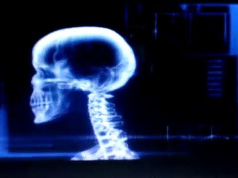 Movie Maker: Skeletal System