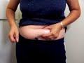 I'm in the middle of my first cycle as an egg donor.