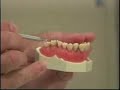 Periodontal Consultation