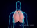 Smoker's Lungs