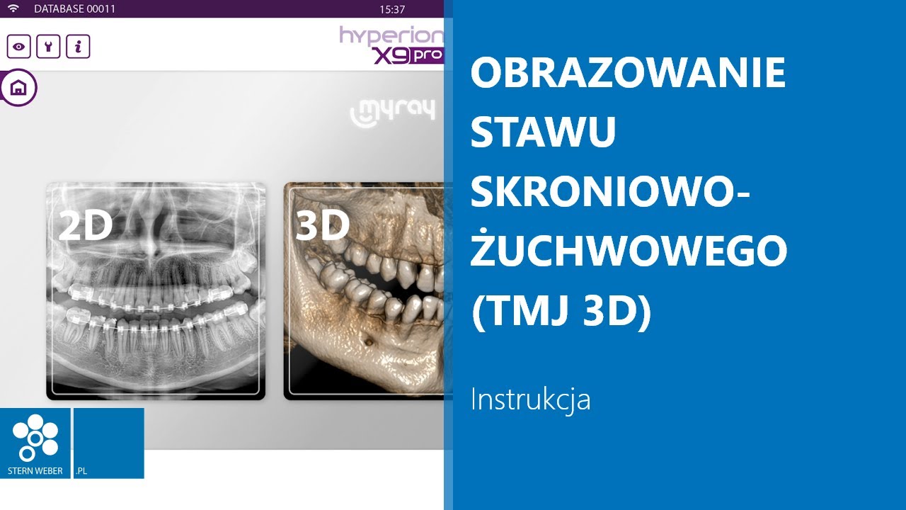 Obrazowanie stawu skroniowo-żuchwowego (TMJ 3D) | Instrukcja wykonywania badania w MyRay Hyperion X9