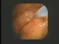 Intestinal Feature & Life-Style Related Diseases Part 2 Intestinal Feature & Life-Style Related Diseases Part 2