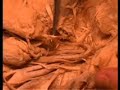 Antamony: 5th Cranial Nerve