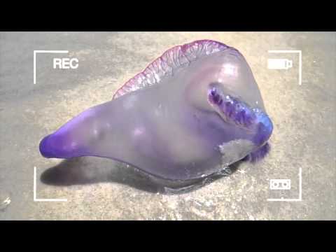 how to treat a portuguese man-o-war sting