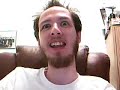 Yes: Open Mouth Surgery