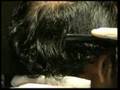 C2G Hair Transplant Video Demo-live surgery with Dr. Cole