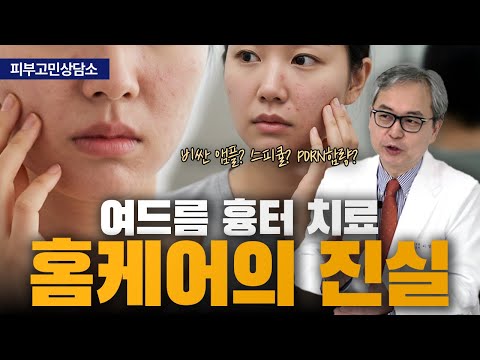 연세스타피부과 TV