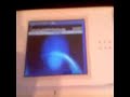 Epileptic Gaming on DS Epileptic Gaming on DS
