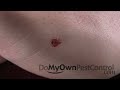 Bed Bug Feeding - Time Lapsed Best Quality HD