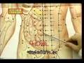 Acupuncture DVD, Chinese Medicine, English Subtitled