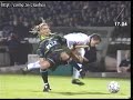 Soccer Accident