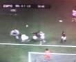 CONTUSÃO DE RONALDO