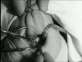 Removal of Tonsils and Adenoids (1930), pt 1 of 2