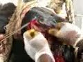 Enucleation Under L Anaesthesia