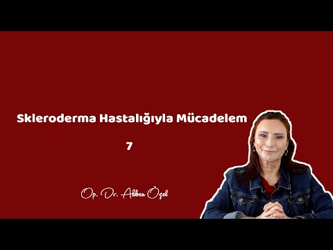 Skleroderma Hastalığıyla Mücadelem 7 - Op. Dr. Akben Özel - 2021.03.03