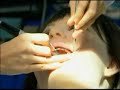 Android Robot used by dentists to detect pain
