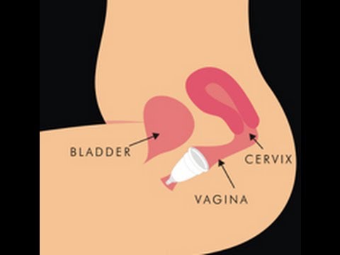 how to use the diva cup