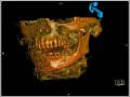 Become a Neurologist