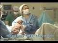 Vídeos de Parto Cesárea - Video 1
