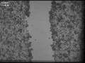 videos de Breast Cancer Cell Migration