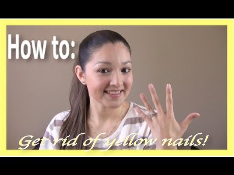 how to get rid yellow toenails