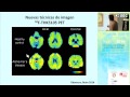 Neurology up to Date Neurology up to Date