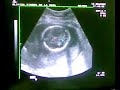 Mi Bebe con 23