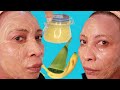 Banana Peel And Aloe Vera For Face