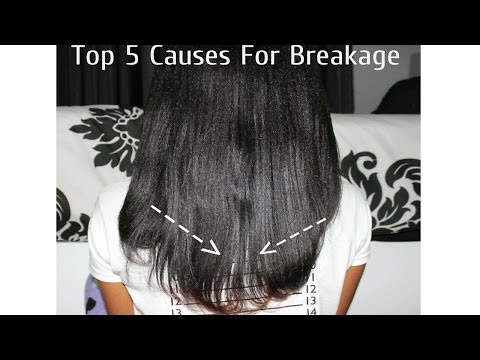 how to treat ethnic hair breakage