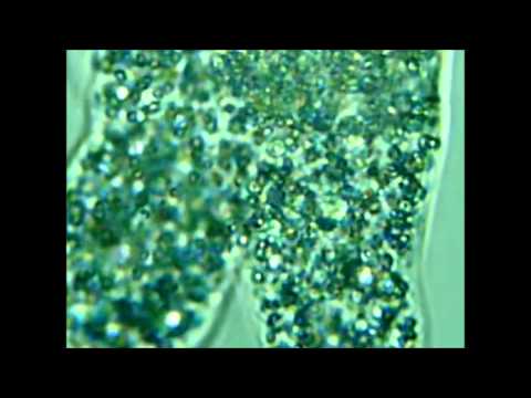 how to treat amoeba