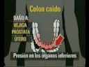 PREVENCION 2