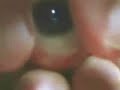 Eyeball Pop Eyeball Pop