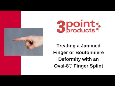 how to treat broken finger