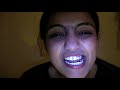 Video testi lambeti