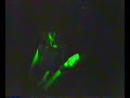 Xmal Deutschland - live 1985 (07/16) - Tag f�r Tag