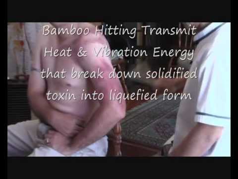 Shoulder Frozen Pain Injury Symdrone Bursitis Muscle Detox Bamboo Healer Master Tiong