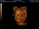 Baby Alexander