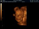 Baby Alexander