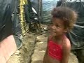 Fome e Desnutri��o no Brasil